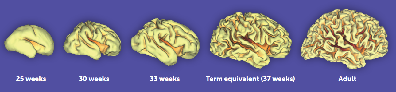 Normal brain development