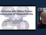 A disease with many faces – phenotypes of osteoarthritis A disease with many faces – phenotypes of osteoarthritis