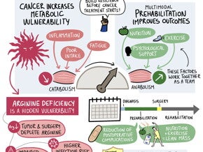  The Prehabilitation Window: Building Metabolic and Immune Resilience