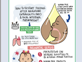 Managing Complications: NEC, BPD, Sepsis — Nutritional Perspectives