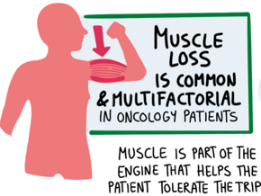  The Invisible Risk: Muscle as the Key Oncologic Vital Sign