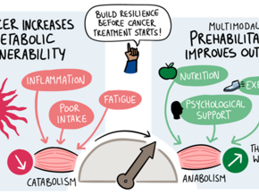  The Prehabilitation Window: Building Metabolic and Immune Resilience