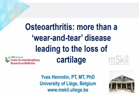 Osteoarthritis more than a wear and tear Osteoarthritis more than a wear and tear