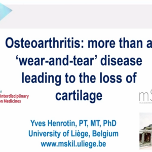 Osteoarthritis more than a wear and tear