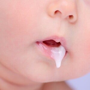 Regurgitation Decision Tree