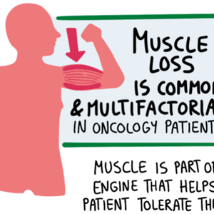 The Invisible Risk: Muscle as the Key Oncologic Vital Sign