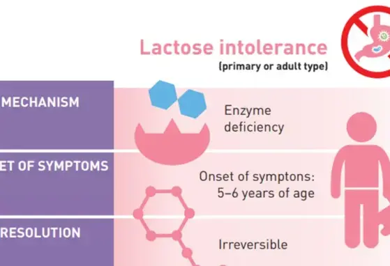 Lactose Intolerance: Common Misunderstandings (infographics) Lactose Intolerance: Common Misunderstandings (infographics)