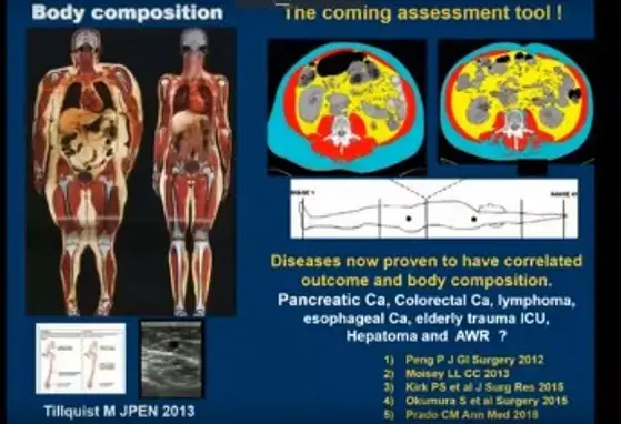 Nutrition in Cancer Therapy: Opportunities for Prevention and Treatment (videos) Nutrition in Cancer Therapy: Opportunities for Prevention and Treatment (videos)