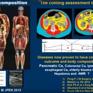 Nutrition in Cancer Therapy: Opportunities for Prevention and Treatment (videos)