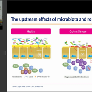 Updates in the Dietary Management of Crohn’s Disease with the Crohn’s Disease Exclusion Diet: Can We Predict Patient’s Response? (videos)