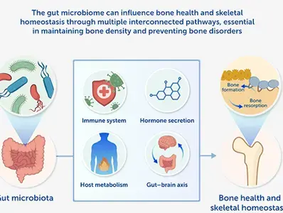 Gut Microbiota-Bone Axis Gut Microbiota-Bone Axis