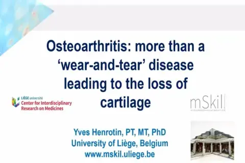 Osteoarthritis more than a wear and tear Osteoarthritis more than a wear and tear