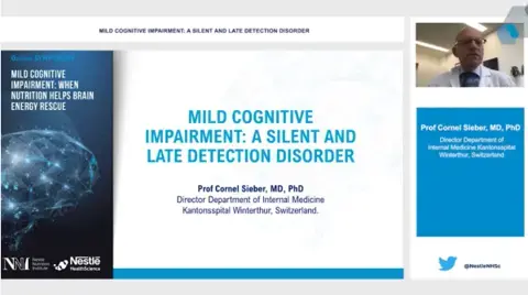 Mild Cognitive Impairment: A silent and late detection disorder (videos) Mild Cognitive Impairment: A silent and late detection disorder (videos)